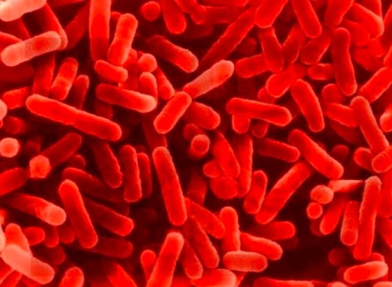 Allarme legionella all’Ospedale di Termini Imerese. Il batterio trovato nell’acqua che fuoriesce dai rubinetti