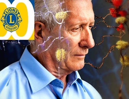 Convegno sull’Alzheimer organizzato dal Lions di Cefalù e Madonie