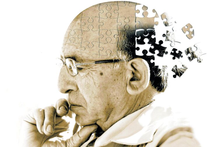 Per gli scienziati esiste una connessione tra l’eccesso zucchero e l’Alzheimer