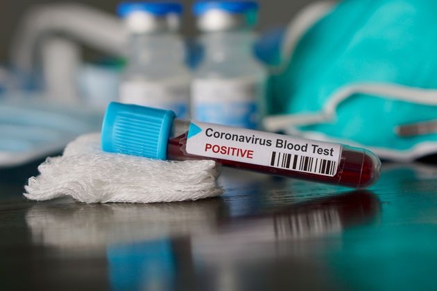 Coronavirus: altri due nuovi casi nelle Madonie, ad Alimena e Castellana Sicula
