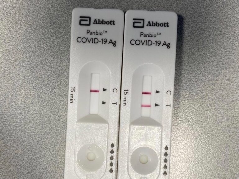 Coronavirus, in Sicilia già in uso 750mila i tamponi “rapidi” a disposizione del Sistema sanitario