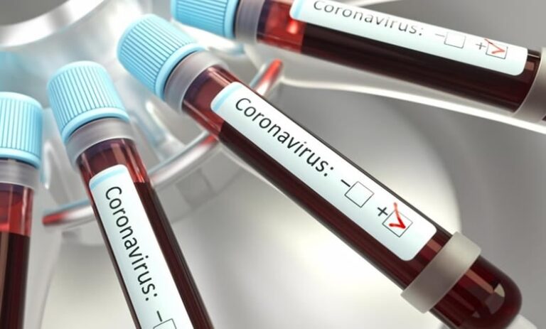 Coronavirus: aumentano in Sicilia i contagiati nelle ultime 24 ore. Il numero più alto nella provincia di Palermo