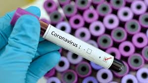 Coronavirus: diminuiscono anche oggi in Sicilia i positivi. Ma la provincia di Palermo resta ancora prima per contagi