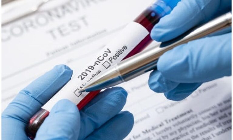 Termini Imerese, diminuiscono positivi al coronavirus mentre aumentano le persone in isolamento fiduciario i “Sospetti positivi”