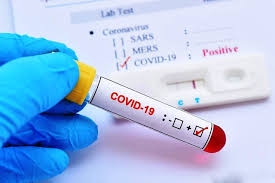 Coronavirus, in Sicilia scendono i positivi, nella provincia di Palermo solo 20 contagi nelle ultime 24 ore