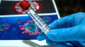 Covid, la Provincia di Palermo ancora prima per contagi in Sicilia: +635 nelle ultime 24ore