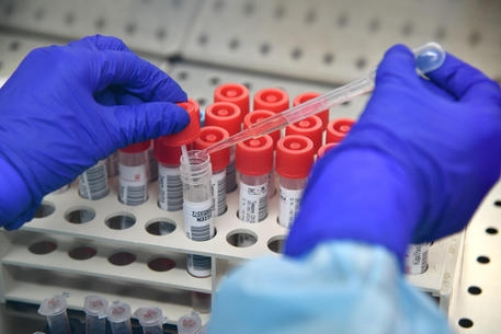 Covid, risalgono in Sicilia i positivi: la Provincia di Palermo ancora prima per contagi